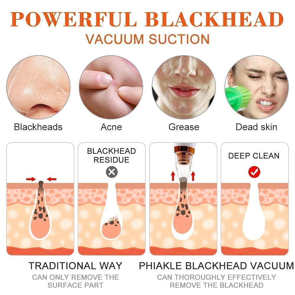 6 in 1 Multi-function Blackhead Remover